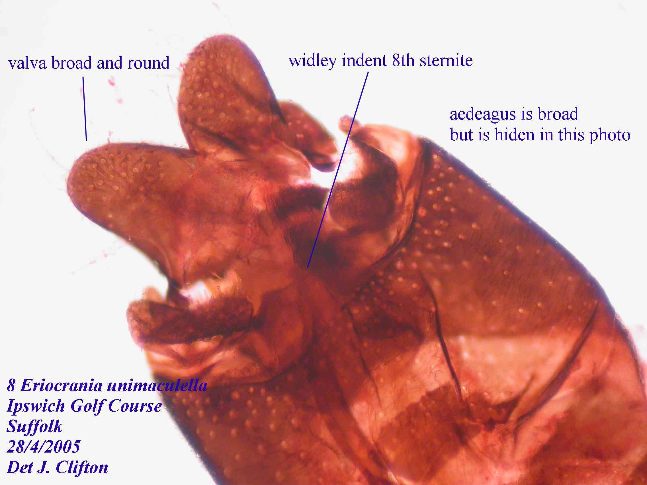 Eriocrania unimaculella genitalia